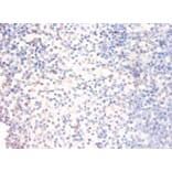 Immunohistochemistry - X-ray repair cross-complementing protein 6 Polyclonal Antibody from Signalway Antibody (42275)