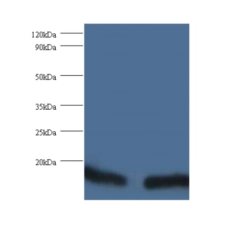 Peptidyl-prolyl cis-trans isomerase FKBP1A Polyclonal Antibody from Signalway Antibody (42342) - Antibodies.com