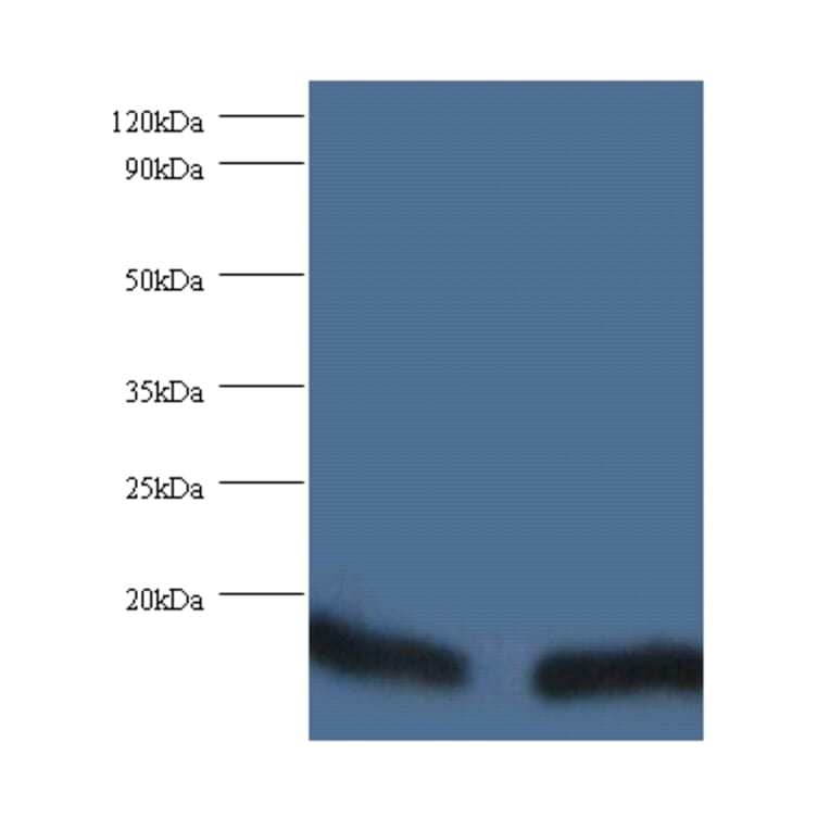 Peptidyl-prolyl cis-trans isomerase FKBP1A Polyclonal Antibody from Signalway Antibody (42342) - Antibodies.com
