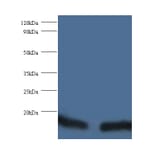 Peptidyl-prolyl cis-trans isomerase FKBP1A Polyclonal Antibody from Signalway Antibody (42342) - Antibodies.com