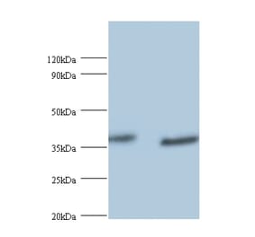 UV excision repair protein RAD23 homolog A Polyclonal Antibody from Signalway Antibody (42402) - Antibodies.com