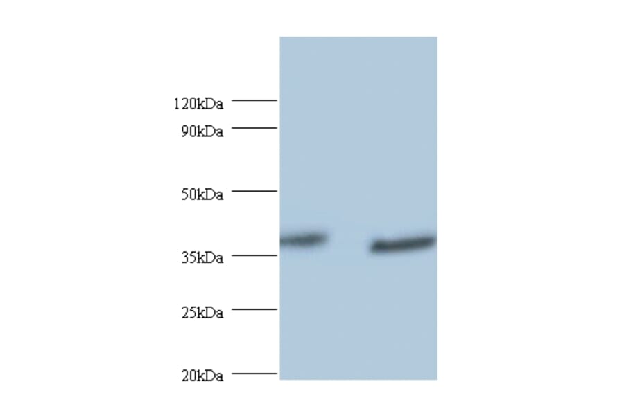 UV excision repair protein RAD23 homolog A Polyclonal Antibody from Signalway Antibody (42402) - Antibodies.com