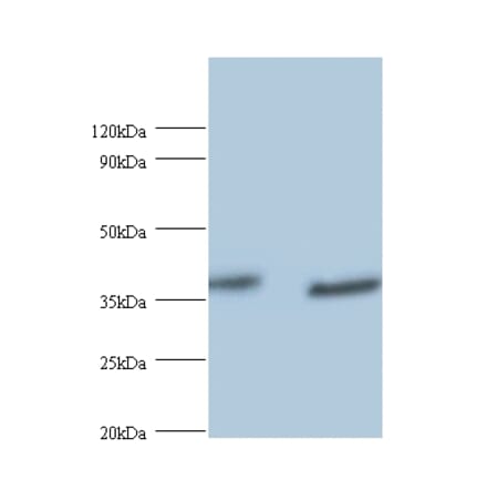 UV excision repair protein RAD23 homolog A Polyclonal Antibody from Signalway Antibody (42402) - Antibodies.com