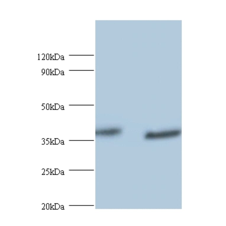 UV excision repair protein RAD23 homolog A Polyclonal Antibody from Signalway Antibody (42402) - Antibodies.com