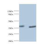 UV excision repair protein RAD23 homolog A Polyclonal Antibody from Signalway Antibody (42402) - Antibodies.com