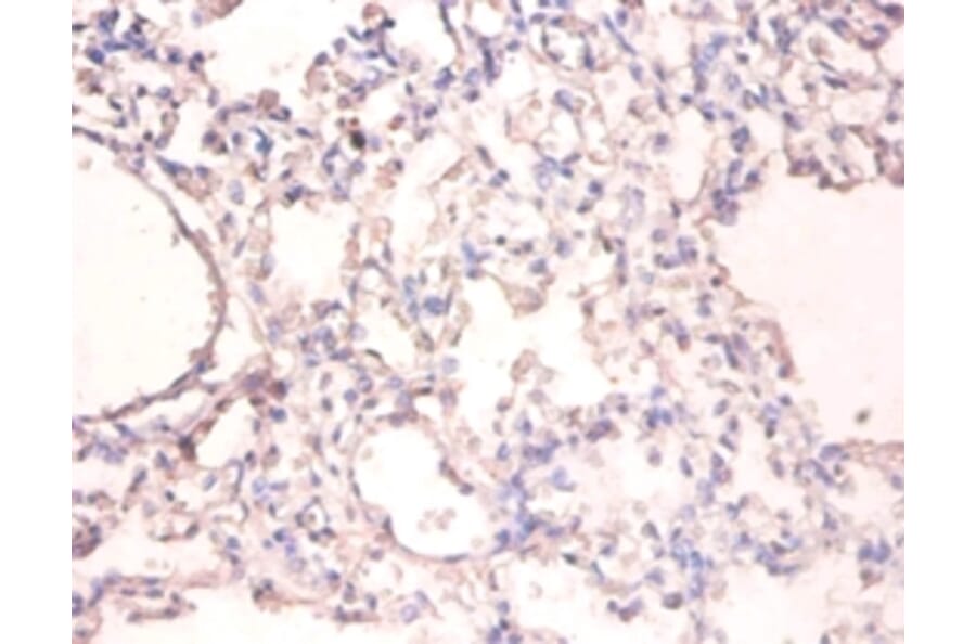 Immunohistochemistry - UV excision repair protein RAD23 homolog A Polyclonal Antibody from Signalway Antibody (42402)