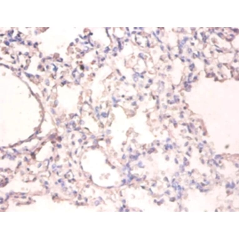 Immunohistochemistry - UV excision repair protein RAD23 homolog A Polyclonal Antibody from Signalway Antibody (42402)