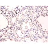 Immunohistochemistry - UV excision repair protein RAD23 homolog A Polyclonal Antibody from Signalway Antibody (42402)