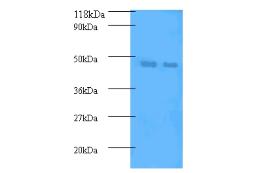 Phosphatidylcholine-sterol acyltransferase Polyclonal Antibody from Signalway Antibody (42536) - Antibodies.com