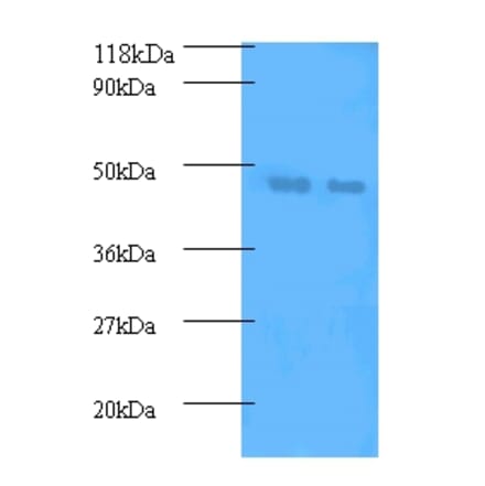Phosphatidylcholine-sterol acyltransferase Polyclonal Antibody from Signalway Antibody (42536) - Antibodies.com