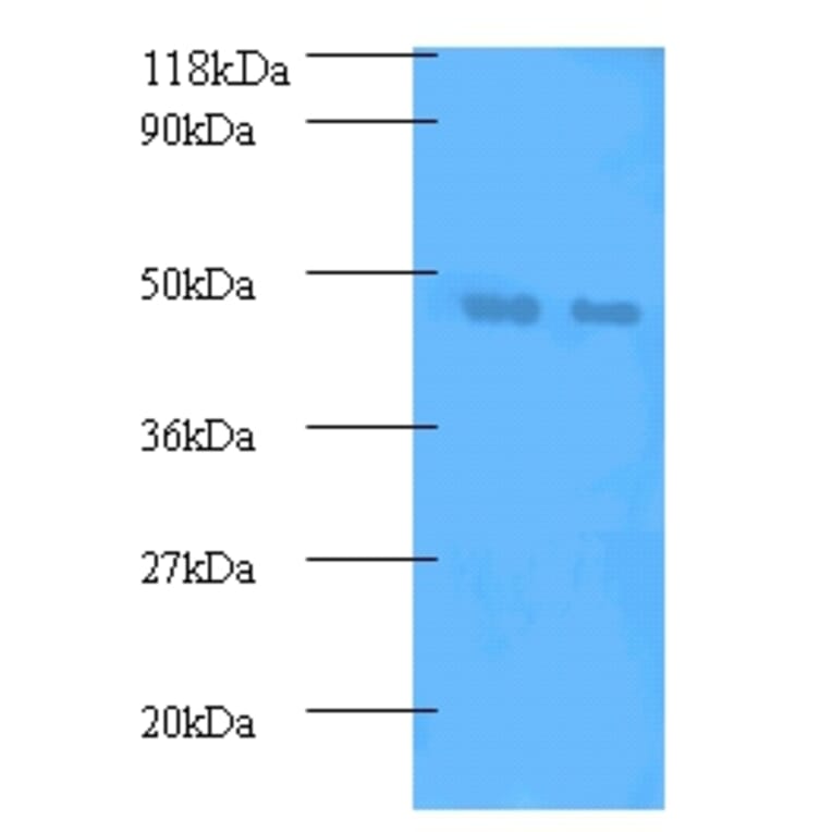 Phosphatidylcholine-sterol acyltransferase Polyclonal Antibody from Signalway Antibody (42536) - Antibodies.com