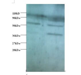 Heterogeneous nuclear ribonucleoprotein Q Polyclonal Antibody from Signalway Antibody (42390) - Antibodies.com