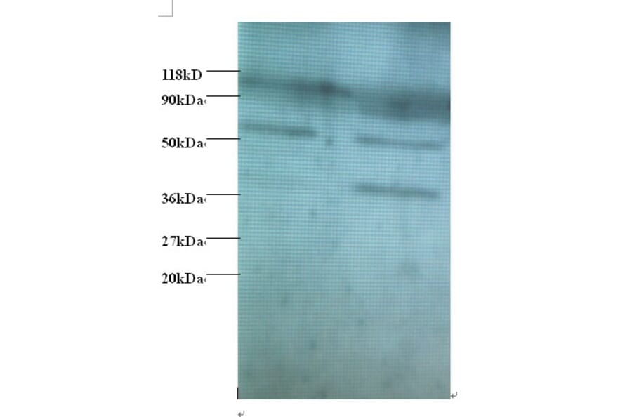 Heterogeneous nuclear ribonucleoprotein Q Polyclonal Antibody from Signalway Antibody (42390) - Antibodies.com