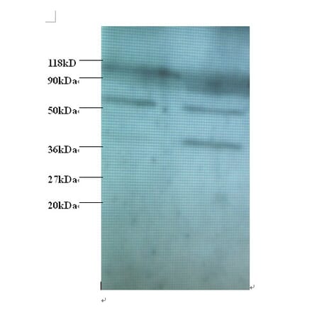 Heterogeneous nuclear ribonucleoprotein Q Polyclonal Antibody from Signalway Antibody (42390) - Antibodies.com