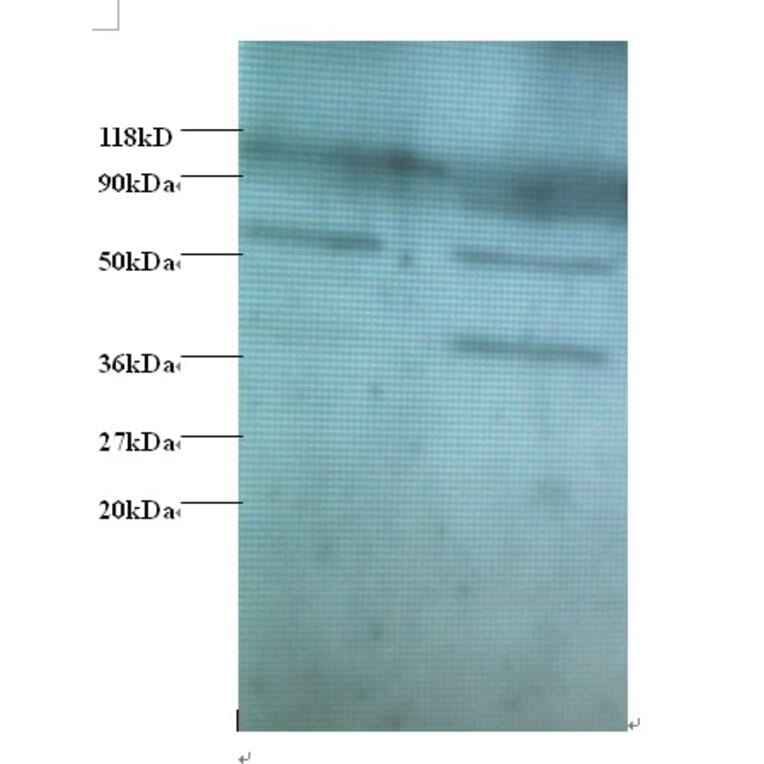 Heterogeneous nuclear ribonucleoprotein Q Polyclonal Antibody from Signalway Antibody (42390) - Antibodies.com