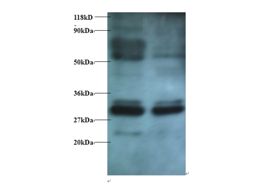 Endoplasmic reticulum resident protein 29 Polyclonal Antibody from Signalway Antibody (42431) - Antibodies.com