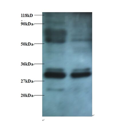 Endoplasmic reticulum resident protein 29 Polyclonal Antibody from Signalway Antibody (42431) - Antibodies.com