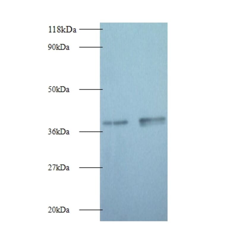 Glyceraldehyde-3-phosphate dehydrogenase Polyclonal Antibody from Signalway Antibody (42052) - Antibodies.com