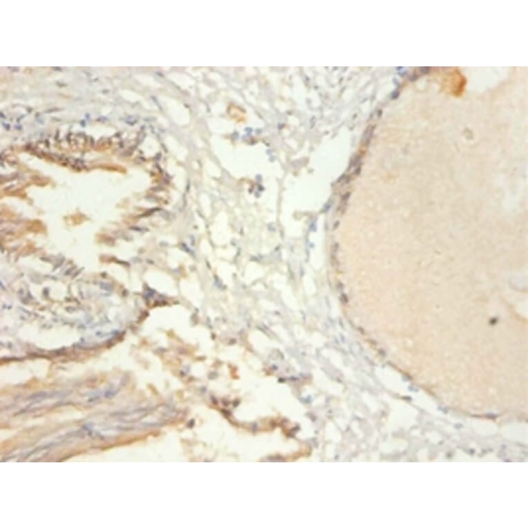 Immunohistochemistry - Transcription intermediary factor 1-beta Polyclonal Antibody from Signalway Antibody (42428)