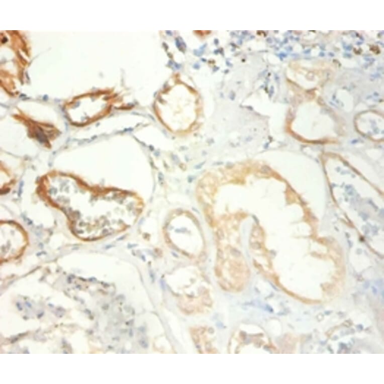 Immunohistochemistry - Transcription intermediary factor 1-beta Polyclonal Antibody from Signalway Antibody (42428)