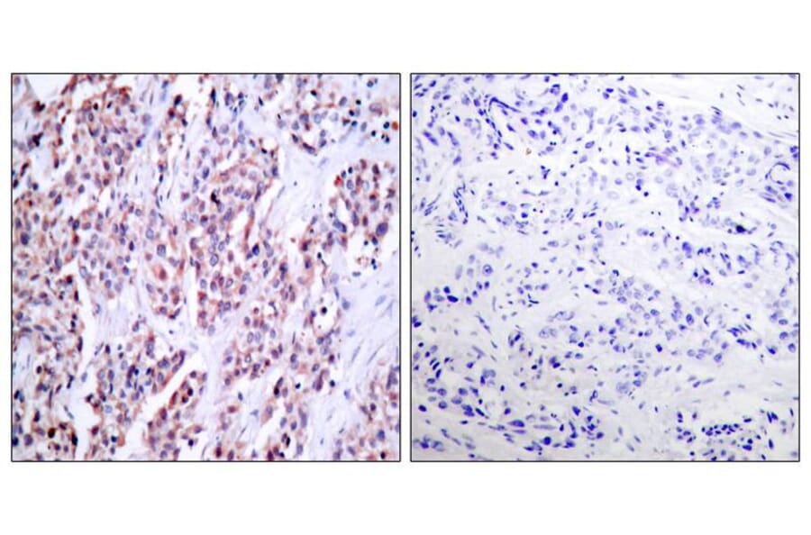 Immunohistochemistry - NFkB-p100 (Ab-870) Antibody from Signalway Antibody (21016) - Antibodies.com