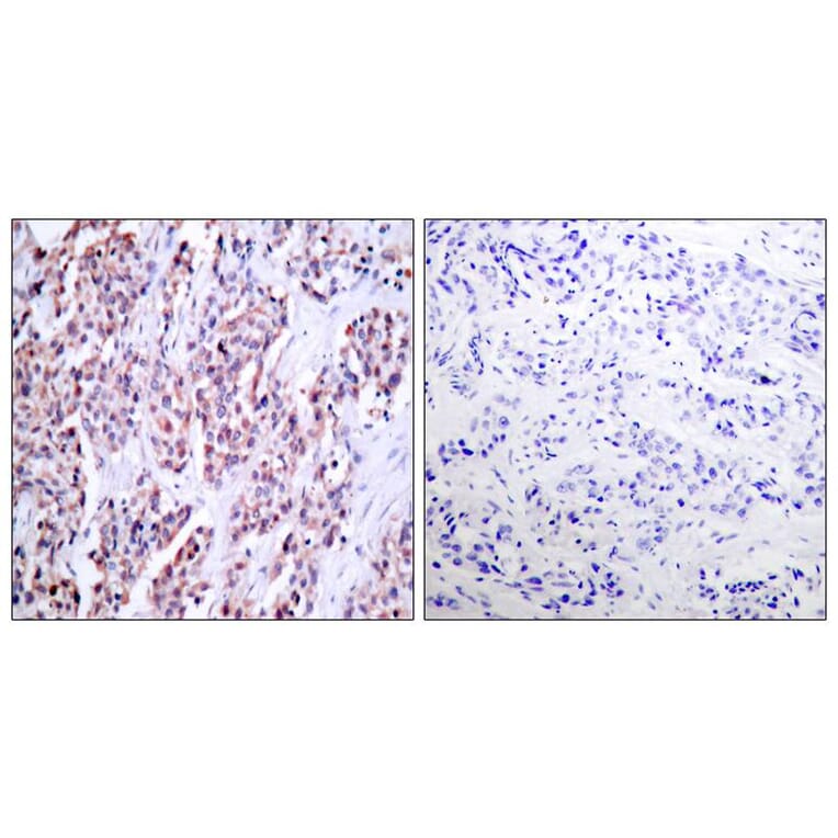 Immunohistochemistry - NFkB-p100 (Ab-870) Antibody from Signalway Antibody (21016) - Antibodies.com