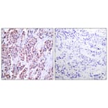 Immunohistochemistry - NFkB-p100 (Ab-870) Antibody from Signalway Antibody (21016) - Antibodies.com