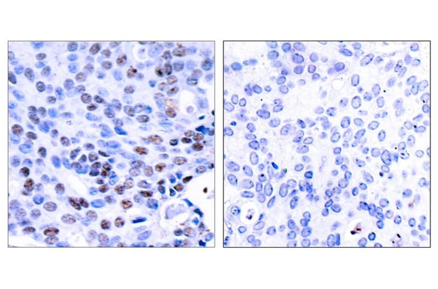 Immunohistochemistry - NFkB-p105/p50 (Ab-337) Antibody from Signalway Antibody (21017) - Antibodies.com