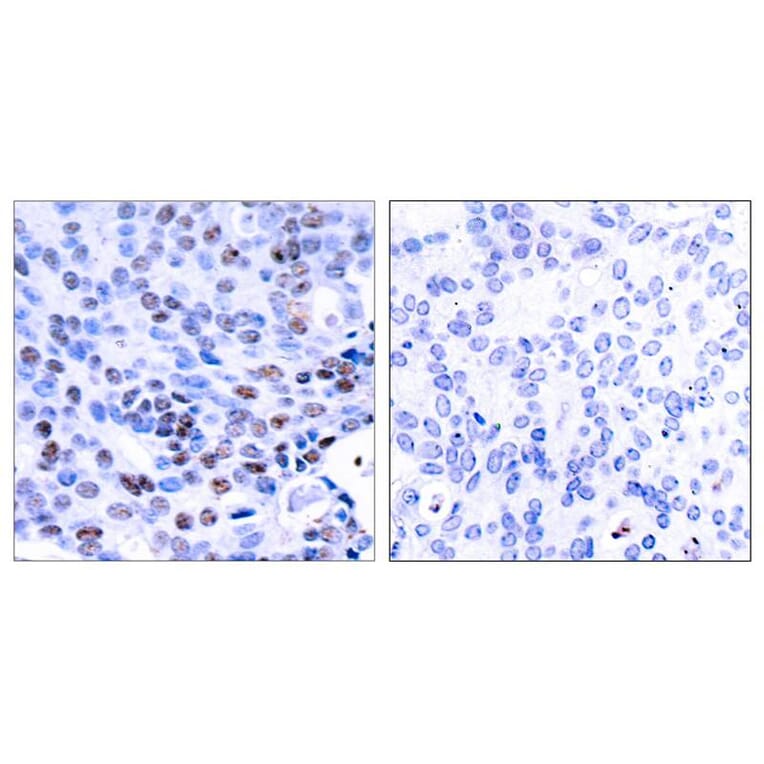Immunohistochemistry - NFkB-p105/p50 (Ab-337) Antibody from Signalway Antibody (21017) - Antibodies.com