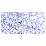 Immunohistochemistry - NFkB-p105/p50 (Ab-337) Antibody from Signalway Antibody (21017) - Antibodies.com