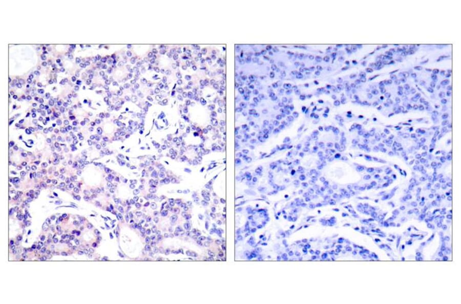 Immunohistochemistry - NFkB-p105 (Ab-893) Antibody from Signalway Antibody (21018) - Antibodies.com