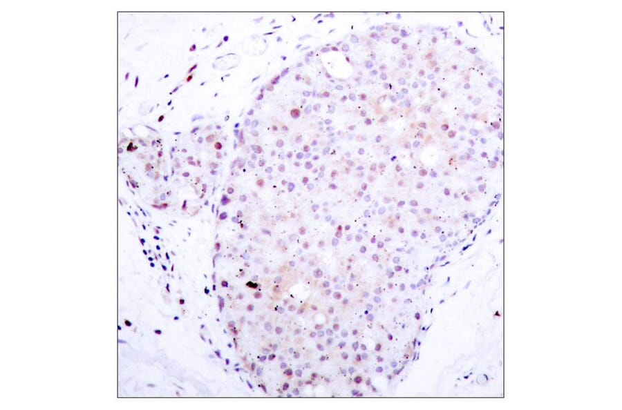 Immunohistochemistry - NFkB-p105 (Ab-907) Antibody from Signalway Antibody (21019) - Antibodies.com