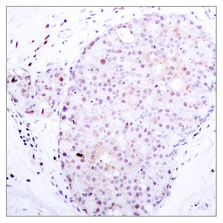 Immunohistochemistry - NFkB-p105 (Ab-907) Antibody from Signalway Antibody (21019) - Antibodies.com