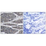 Immunohistochemistry - NFkB-p105 (Ab-932) Antibody from Signalway Antibody (21243) - Antibodies.com