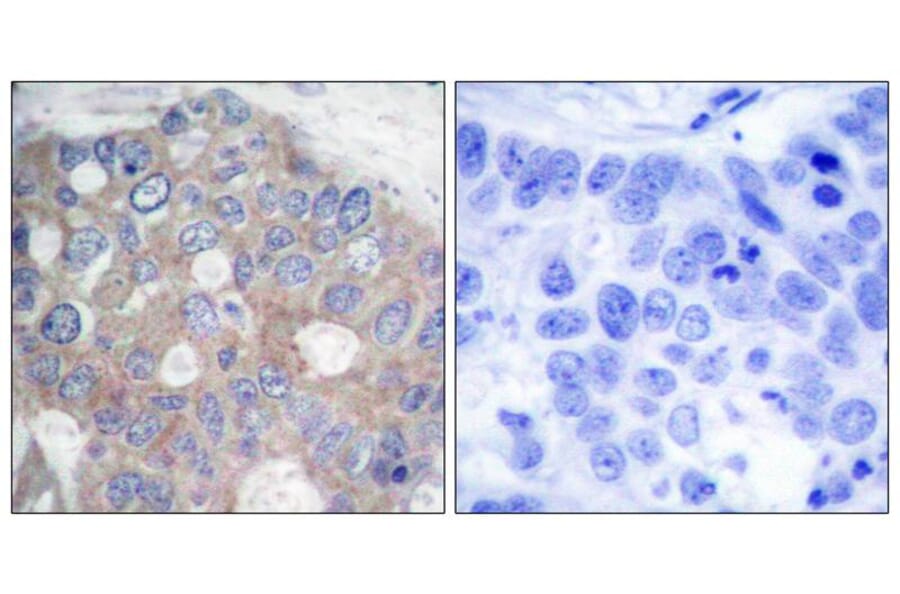 Immunohistochemistry - p70 S6 Kinase (Ab-421) Antibody from Signalway Antibody (21246) - Antibodies.com