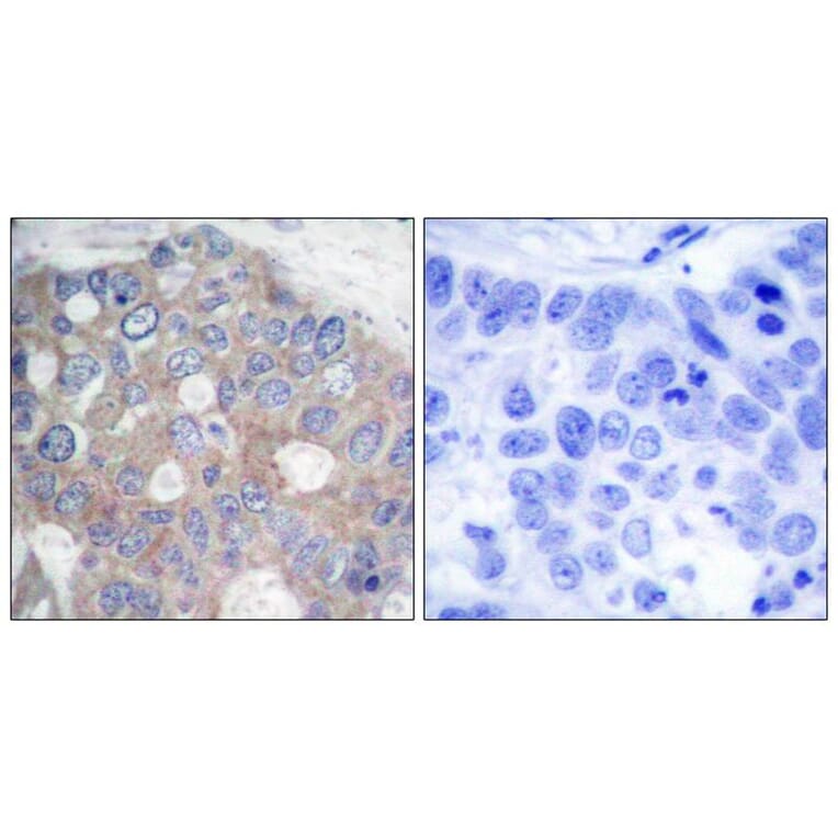 Immunohistochemistry - p70 S6 Kinase (Ab-421) Antibody from Signalway Antibody (21246) - Antibodies.com