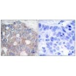 Immunohistochemistry - p70 S6 Kinase (Ab-421) Antibody from Signalway Antibody (21246) - Antibodies.com