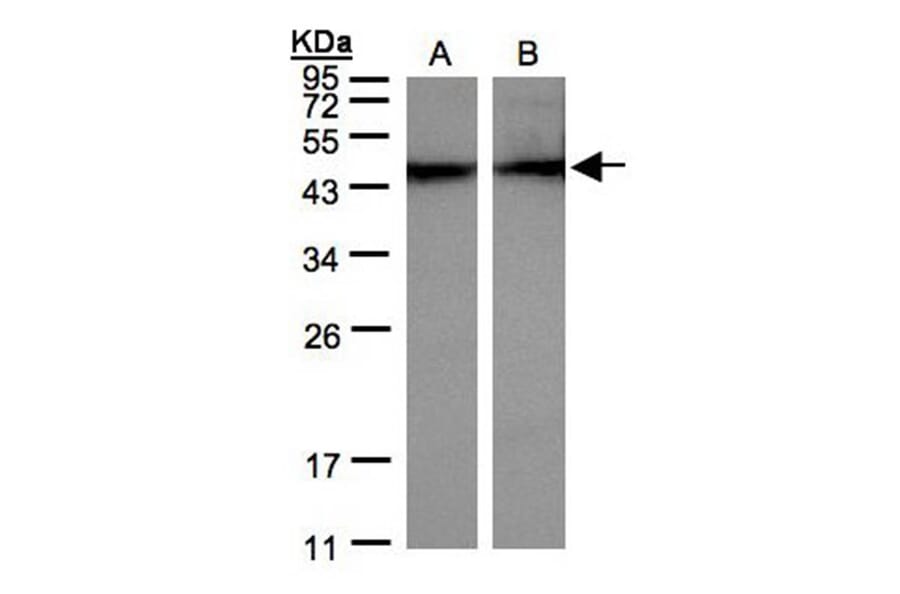 alpha sarcomeric Actin antibody from Signalway Antibody (22958) - Antibodies.com