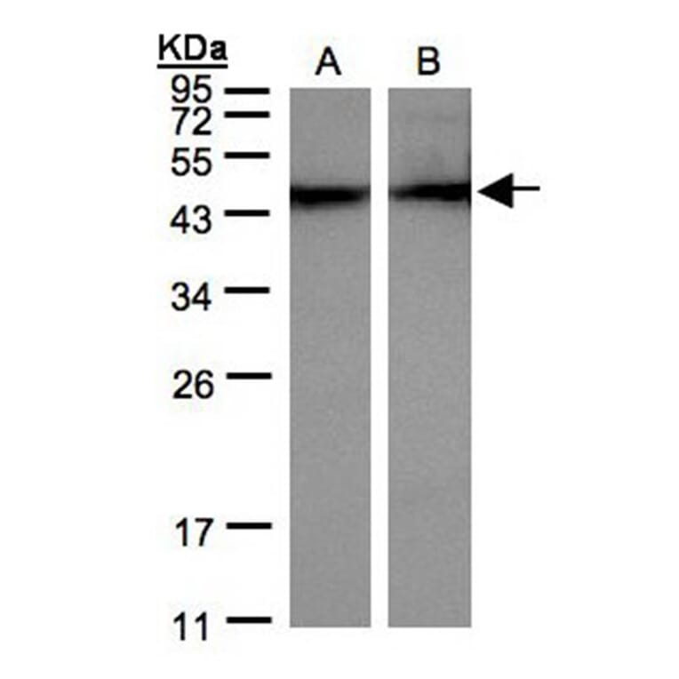 alpha sarcomeric Actin antibody from Signalway Antibody (22958) - Antibodies.com