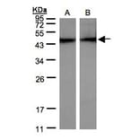 alpha sarcomeric Actin antibody from Signalway Antibody (22958) - Antibodies.com
