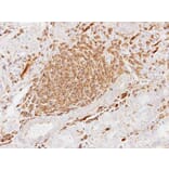 Immunohistochemistry - alpha sarcomeric Actin antibody from Signalway Antibody (22958) - Antibodies.com