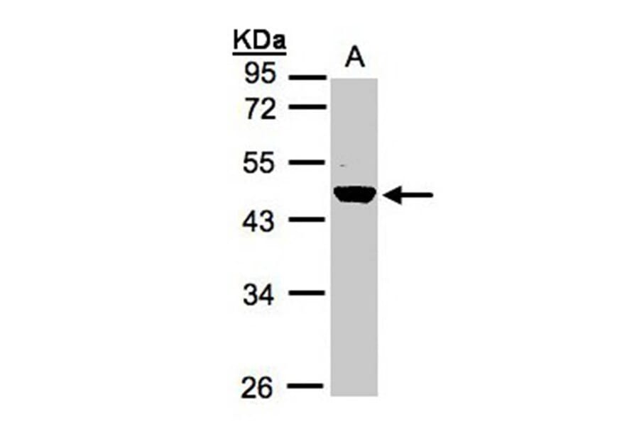 Renin in preproprotein antibody from Signalway Antibody (23067) - Antibodies.com