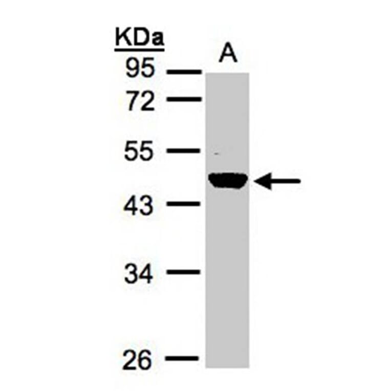 Renin in preproprotein antibody from Signalway Antibody (23067) - Antibodies.com