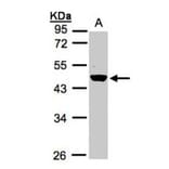 Renin in preproprotein antibody from Signalway Antibody (23067) - Antibodies.com