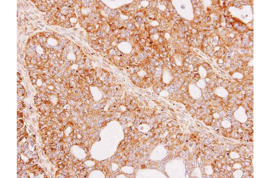 Immunohistochemistry - Renin in preproprotein antibody from Signalway Antibody (23067) - Antibodies.com