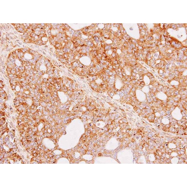 Immunohistochemistry - Renin in preproprotein antibody from Signalway Antibody (23067) - Antibodies.com