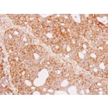 Immunohistochemistry - Renin in preproprotein antibody from Signalway Antibody (23067) - Antibodies.com