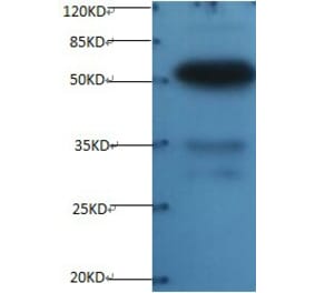 Osteopontin Monoclonal Antibody from Signalway Antibody (42036) - Antibodies.com