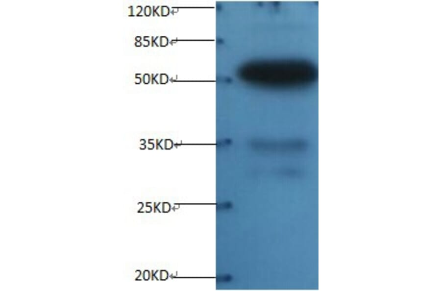 Osteopontin Monoclonal Antibody from Signalway Antibody (42036) - Antibodies.com
