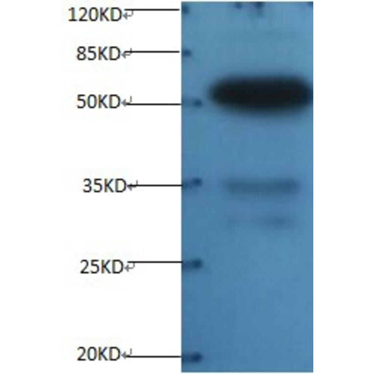 Osteopontin Monoclonal Antibody from Signalway Antibody (42036) - Antibodies.com